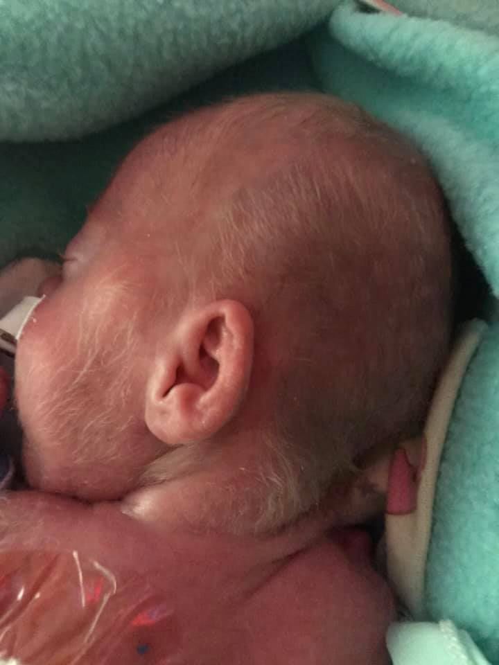 keelydec31startingtogrowhair.jpg